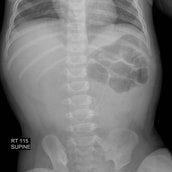 Pediatric Radiology Cases