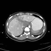 Abdominal Radiology Imaging Cases