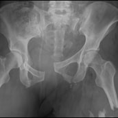Adult Ortho Radiology Cases